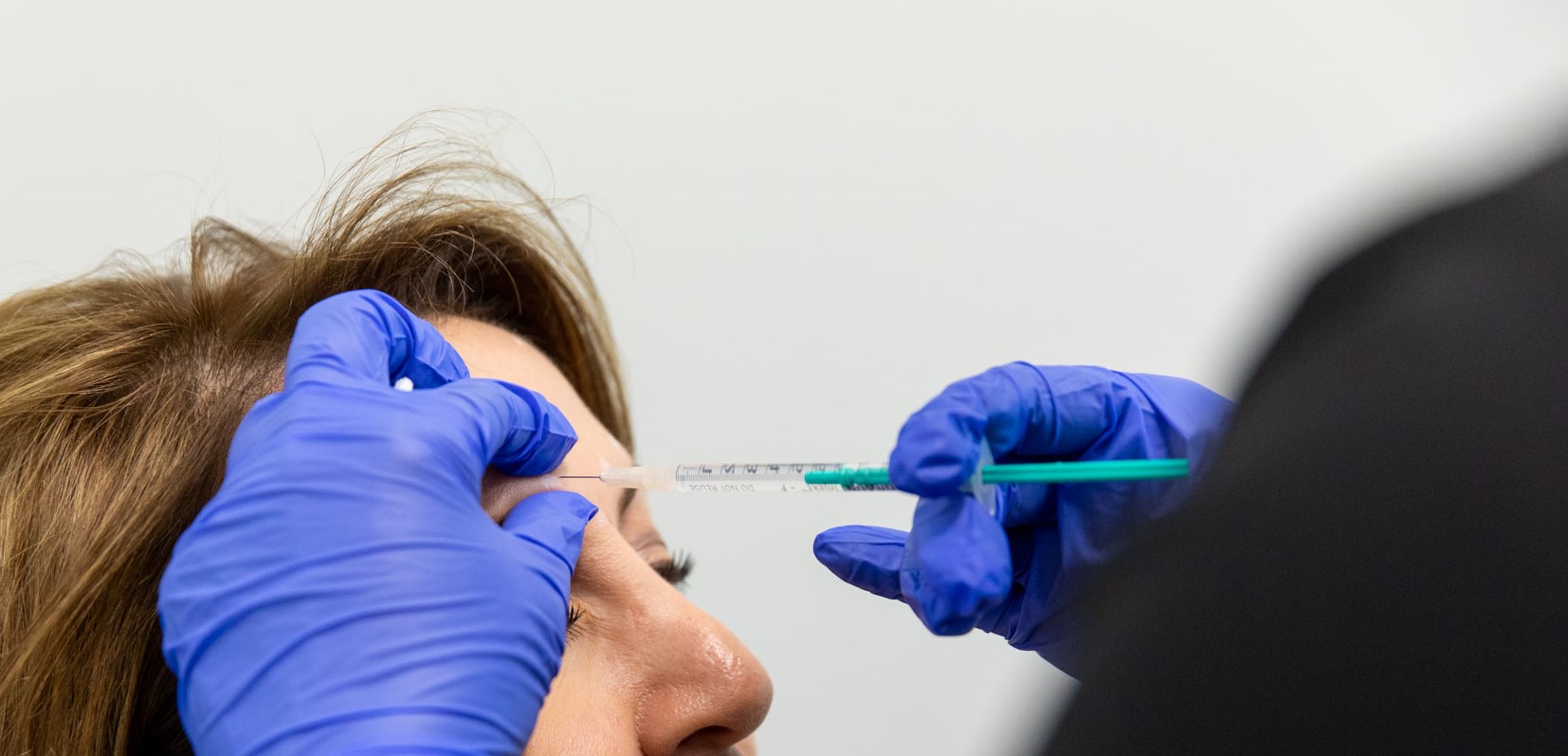 woman gets anti wrinkle injections in Sterling Heights in her forehead
